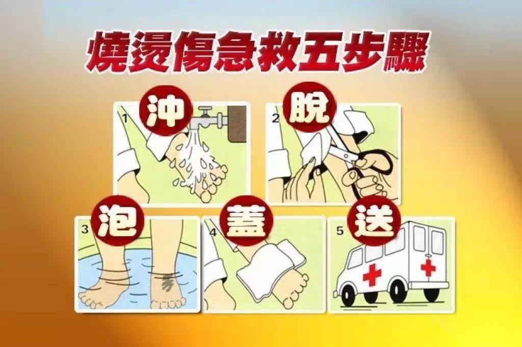 烫伤后涂牙膏能缓解创面不适吗